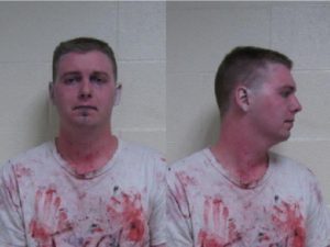 Battery